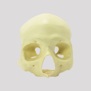 CRANIO FRONTAL All-on-4® ZIGOMA RADIOPACO - cód. 12260