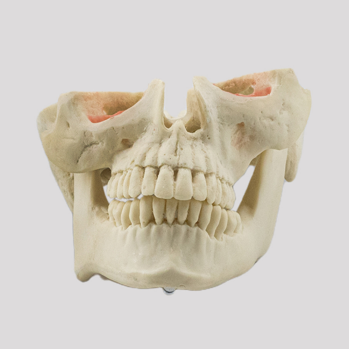 MANEQUIM COM ASSIMETRIA FACIAL SEVERA