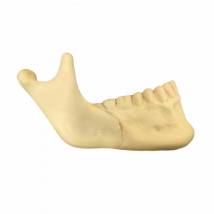 1/2 MANDÍBULA DIREITA COM CORTE DE OSTEOTOMIA SAGITAL - cód. 11976