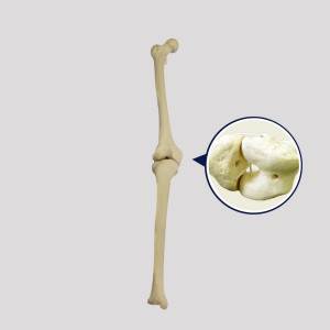 JOELHO RADIOPACO DIREITO COM CANAL MEDULAR E SIMULAÇÃO DE LIGAMENTOS - cód. 12379