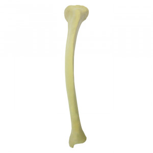 TIBIA RADIOPACA ESQUERDA COM DEFORMIDADE 2 PLANOS MEDIAL POSTERIOR VALGO - cód. 12443