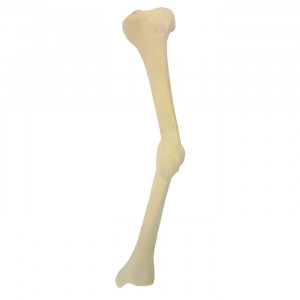 TIBIA RADIOPACA ESQUERDA COM DEFORMIDADE MEDIAL E MÁ CALCIFICAÇÃO - cód. 12445