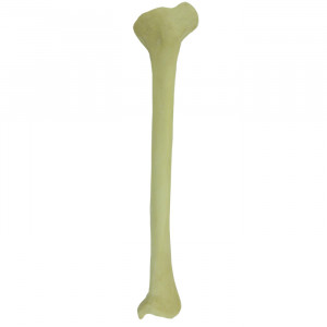 TÍBIA  RADIOPACA ESQUERDA COM DEFORMIDADE PROXIMAL VARO ROTAÇÃO INTERNA - cód. 12450