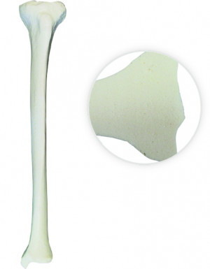 TIBIA RADIOPACA DIREITA COM CANAL MEDULAR E ESPONJOSO - cód. 12372