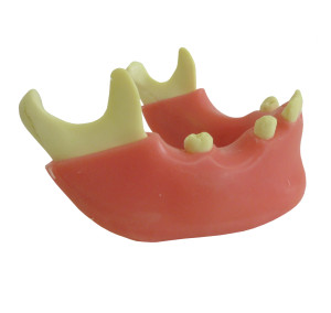 MANDÍBULA COM ALGUNS DENTES E GENGIVA - cód. 4012 G 
