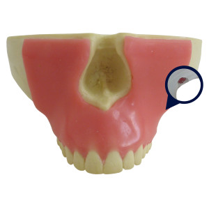 MAXILA COM TODOS OS DENTES, GENGIVA E 3º MOLAR INCLUSO - cód. 4402 G-01