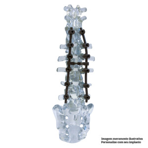 COLUNA LOMBO-SACRA + VERTEBRAS T10, T11 E T12 EM ACRILICO TRABALHADO - cód. 5013AI-OUT