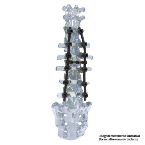 COLUNA LOMBO-SACRA + VERTEBRAS T10, T11 E T12 EM ACRÍLICO TRABALHADO - cód. 5013AI