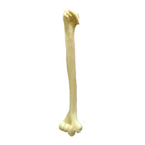 UMERO DIR COM OSTEOARTRITE - cód. S 3012 OT